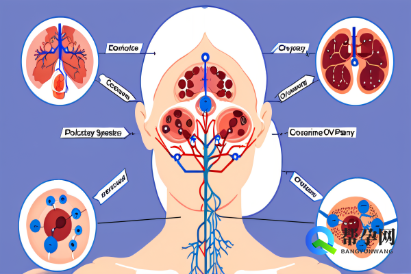 多囊肝胆红素高怎么办？专家为您解答